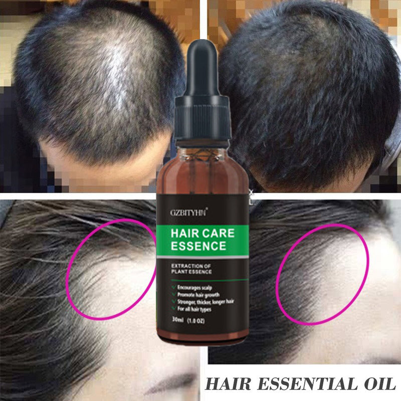 Hair Growth Oil