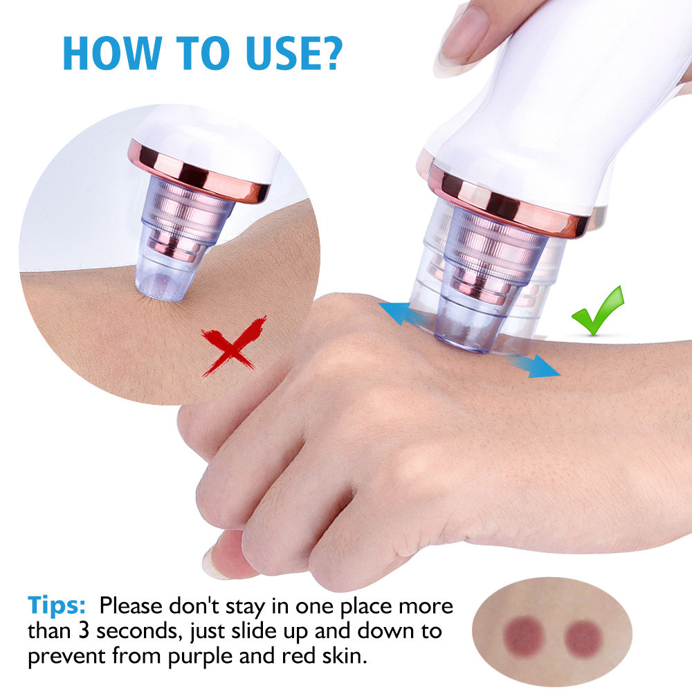 Electric Blackhead Suction Instrumen