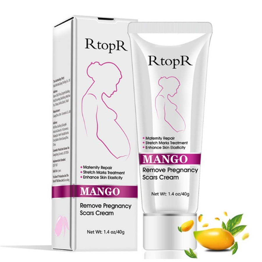 Natural Mild Non-irritating Mango Remove Stretch Mark Cream For Pregnancy Repair